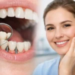 İmplant Sonrası Şişlik Nasıl Geçer?